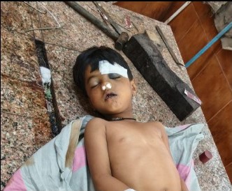 खेलने के दौरान छतसे गिरने पर मासूम की मौत