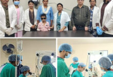 मेकाॅज के डॉक्टरों ने दो बच्चों की आंख की लौटाई रौशनी