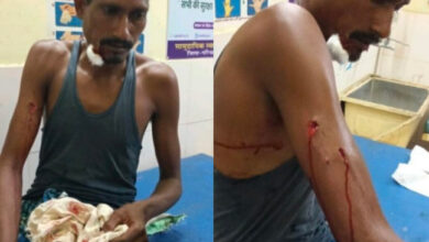 पाण्डुका वन क्षेत्र में तेंदुए ने किया ग्रामीण पर हमला, सिर और हाथ में आई गंभीर चोटें