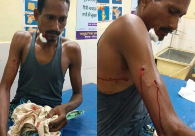 पाण्डुका वन क्षेत्र में तेंदुए ने किया ग्रामीण पर हमला, सिर और हाथ में आई गंभीर चोटें