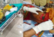 कोहलाकसा के जंगल में तेंदूपत्ता तोडऩे गई महिलाओं पर सूअर ने किया हमला, 5 गंभीर, एक ही हालत नाजुक