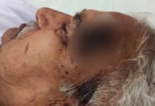 गोरखपुर में पूर्व मंत्री गंगा प्रसाद निषाद पर जानलेवा हमला