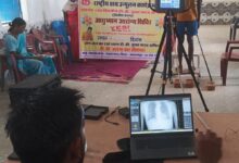 टीबी मुक्त छत्तीसगढ़ की दिशा में बड़ा कदम, 90 शिविरों में 7 हजार से अधिक लोगों की जांच