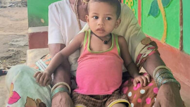 जन्म से बंद थे मलद्वार और मूत्र मार्ग, दो सफल ऑपरेशनों ने बदली तीन वर्षीय अरुलेश की जिंदगी जन्म से बंद थे मलद्वार और मूत्र मार्ग, दो सफल ऑपरेशनों ने बदली तीन वर्षीय अरुलेश की जिंदगी