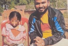 पत्थर शरीर वाली बच्ची के उपचार को लेकर बाल आयोग सक्रिय, बच्ची को मिली उसके नाम पर जुटाई गई सहायता राशि