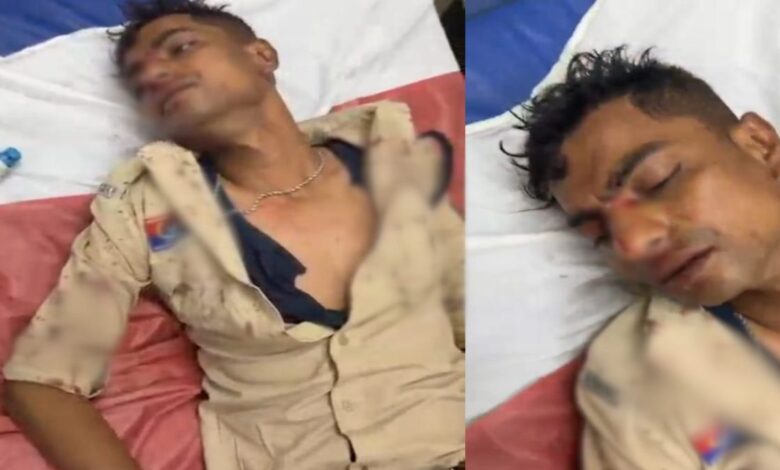 बिलासपुर में पुलिसकर्मी पर हमला, डायल-112 आरक्षक को डंडे से पीटा