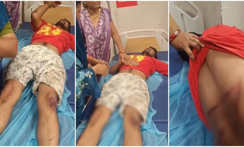 शराब के लिए पैसे मांगने पर विवाद, विधायक के बेटे से मारपीट